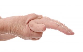 Arthritis & Rheumatic Disease Specialties, Florida, Aventura, Other disorders of wrist and hand