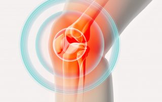 Arthritis & Rheumatic Disease Specialties, osteoarthritis of the knee, Look at Osteoarthritis Photo