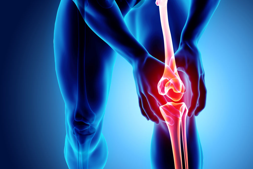 Arthritis & Rheumatic Disease Specialties, Conditions, osteoarthritis of the knee, Osteoarthritis Photo